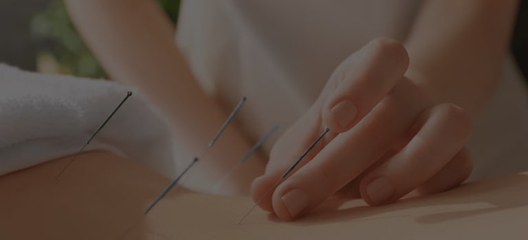 Acupuncture Treatment Ealing