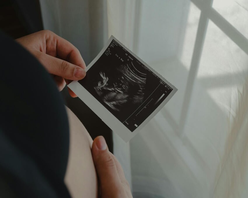 Growth and Presentation Baby Scan 