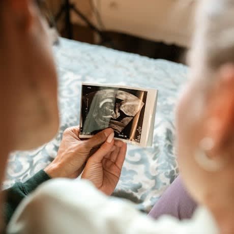 When Is the Best Time for a 4D Baby Scan?