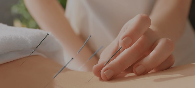 Acupuncture Treatment Ealing