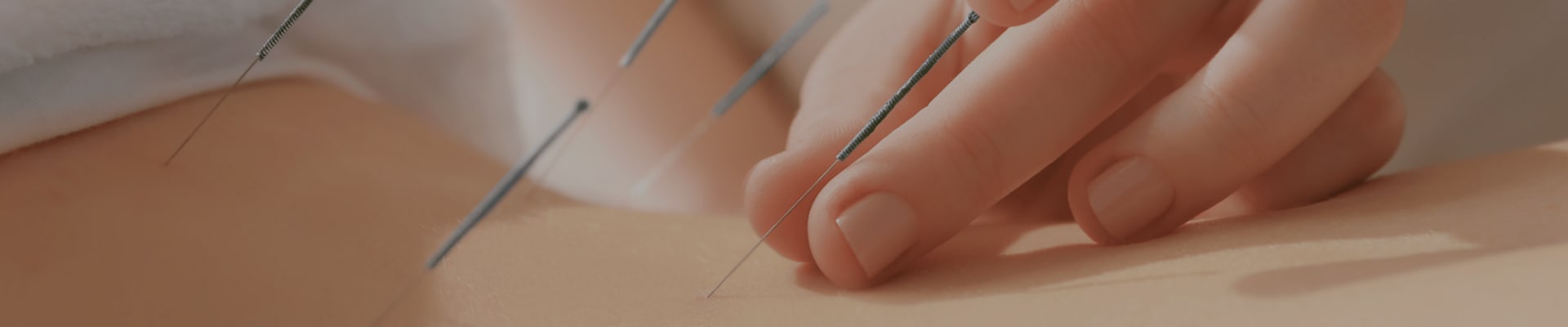 Acupuncture Treatment Ealing