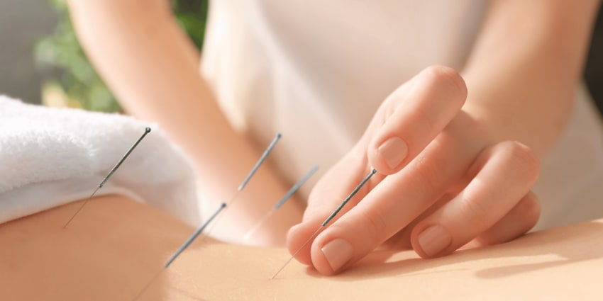 Acupuncture Treatment Ealing
