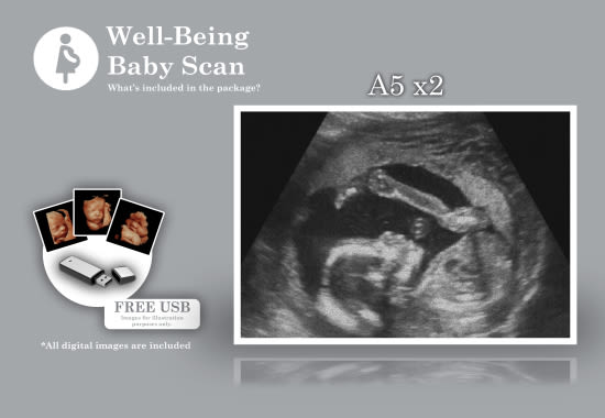 Private baby scan, Well-being baby scan, Promotional Baby scan, Ultrasound baby scan