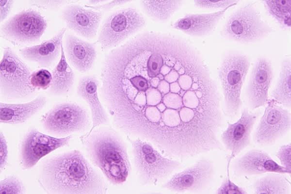 Physiotherapy for Cancer Patients in London &amp; Essex | Improve Mobility &amp; Manage Symptoms