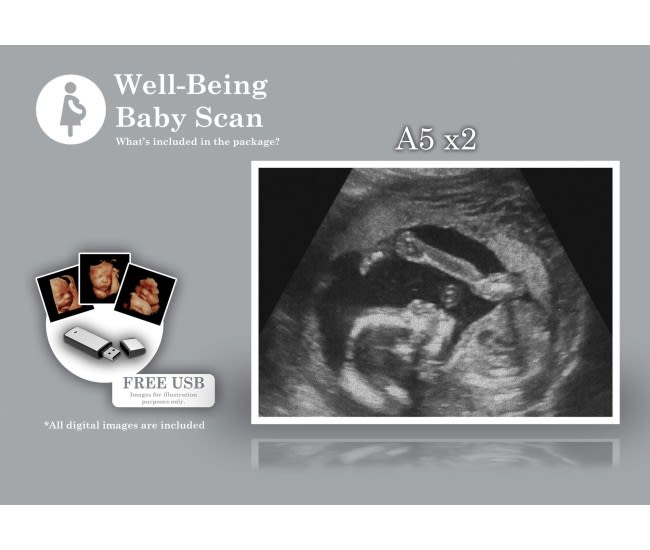 Baby scan, Private baby scan, Promotional baby scan, well-being baby scan