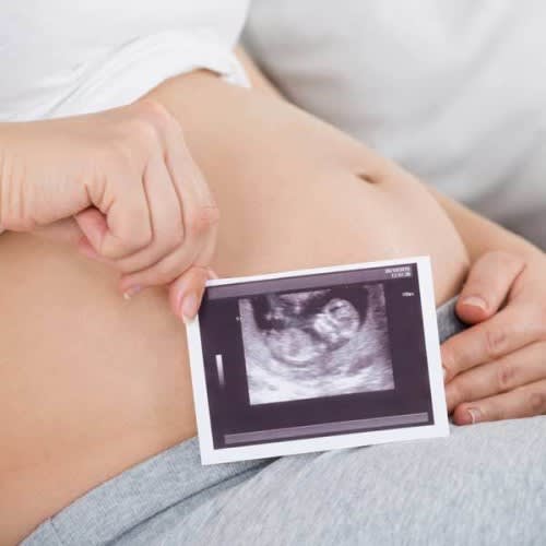 Gender Reveal (Sexing) Baby Scan