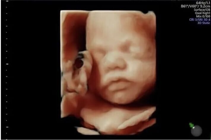 3D 4D HD Baby Scans