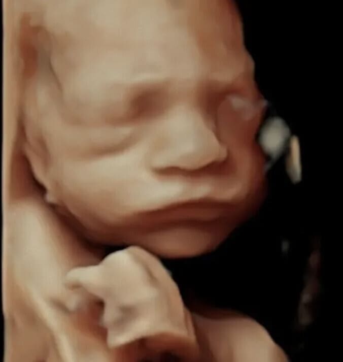 3D 4D HD Baby Scans
