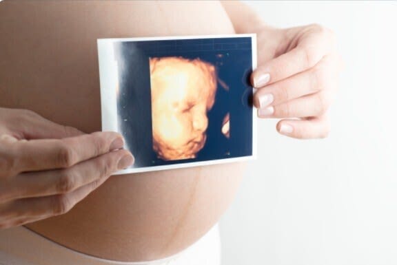 3 x Well-Being Scan (Free 4D Peek)