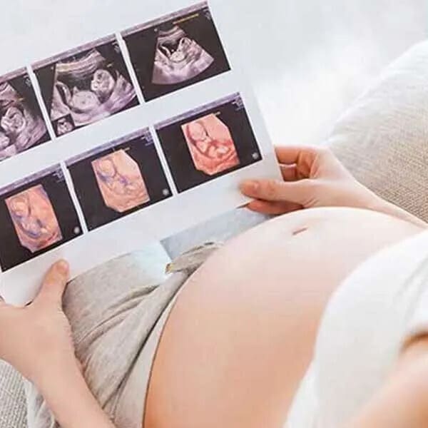 pregnancy scans