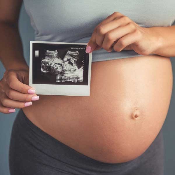 Ultrasound baby scan photo