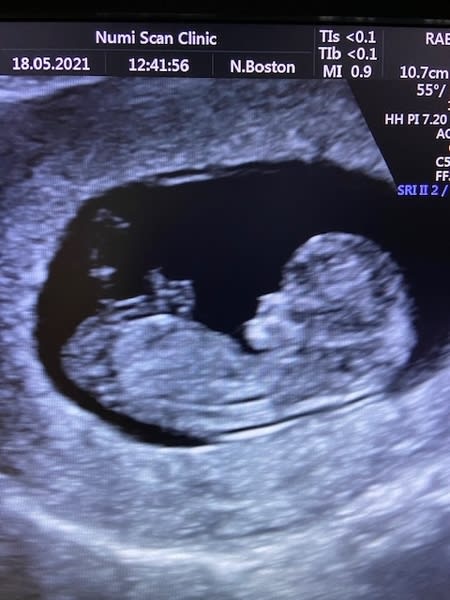 26 weeks ultrasound boy