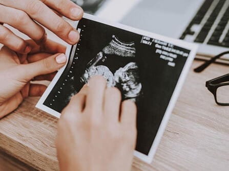 baby scan