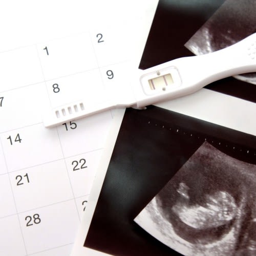 Early Pregnancy, Reassurance, Viability Baby Scan