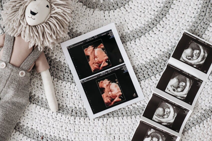 4D Baby Scan