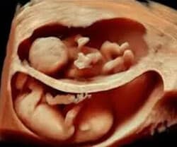 24-34 weeks 4D Baby Bonding Scans