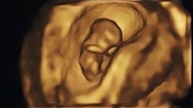 baby-scan