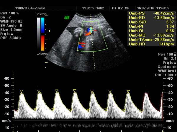 Well-being Scan