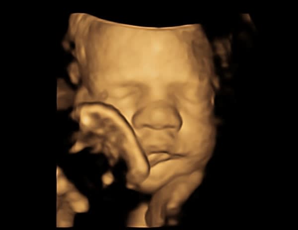 4D Obs Sonographer roles