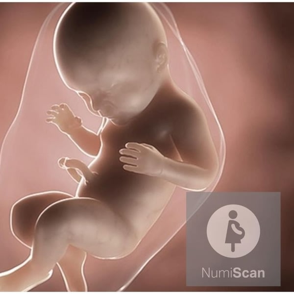 Noninvasive Prenatal Testing (NIPT)