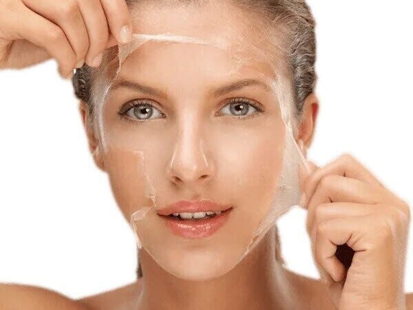 Skin anatomy & Chemical Peels