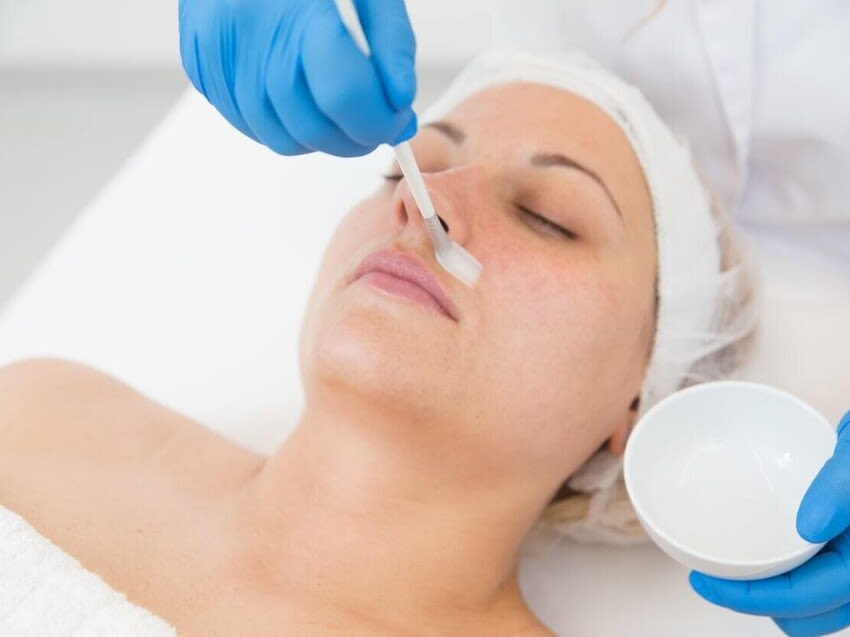 Skin anatomy & Chemical Peels