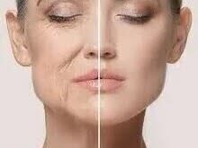 All about skin- microneedling/ dermaplaning + peels