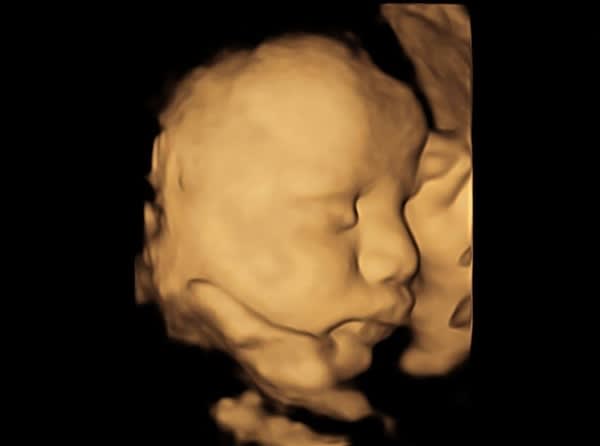 Ultrasound Scans in Pregnancy: Exploring Key Milestones and Expectations with Numi Scan