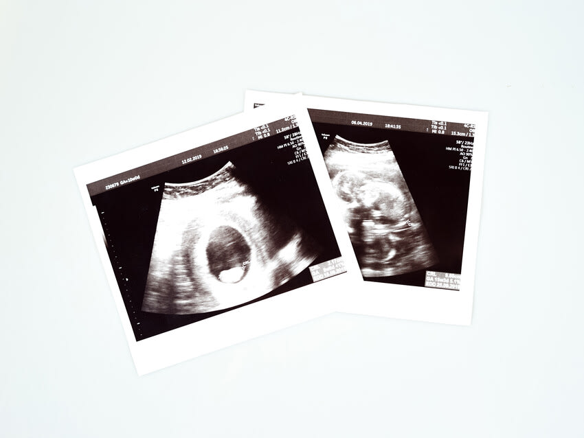 Head to Toe & Presentation Scan (16 - 40 Weeks)