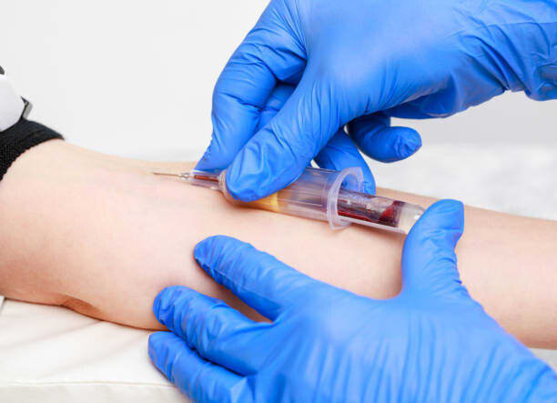 venepuncture and cannulation