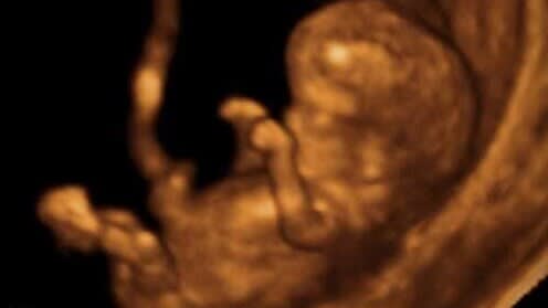 baby scan