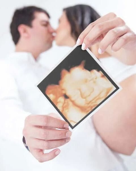 baby scan