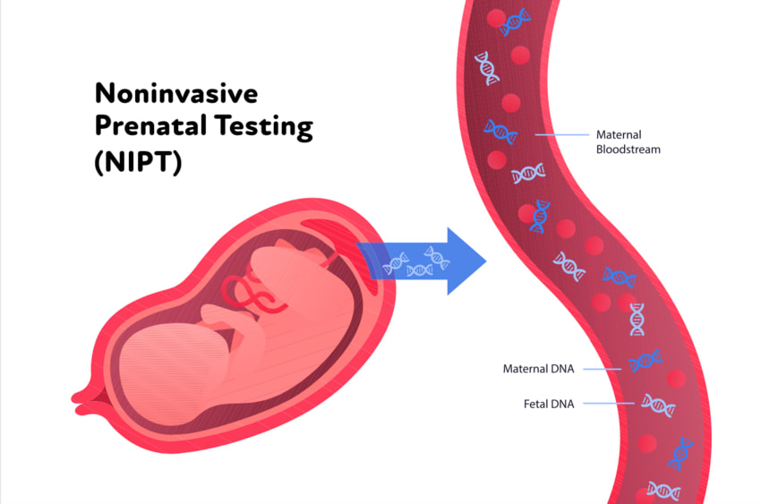 Non-Invasive Prenatal Screening Test (NIPT)