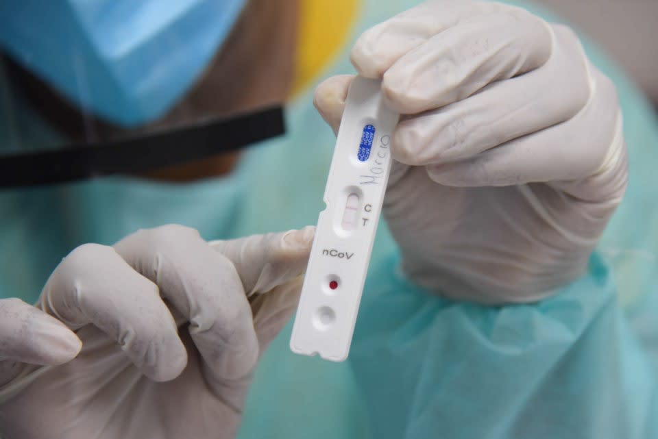 Brasil confirma mais 983 Ã³bitos e se aproxima de 130 mil mortes