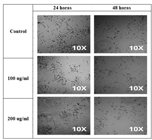 Ingeniería para el Desarrollo