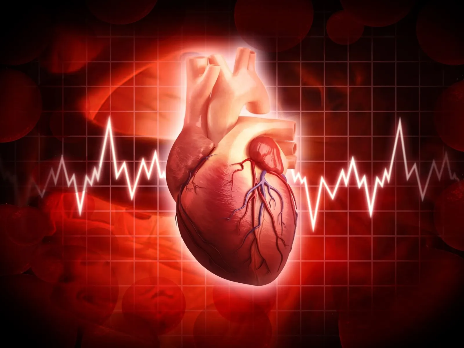 Understanding the Jargon: Electrocardiograms (ECGs)
