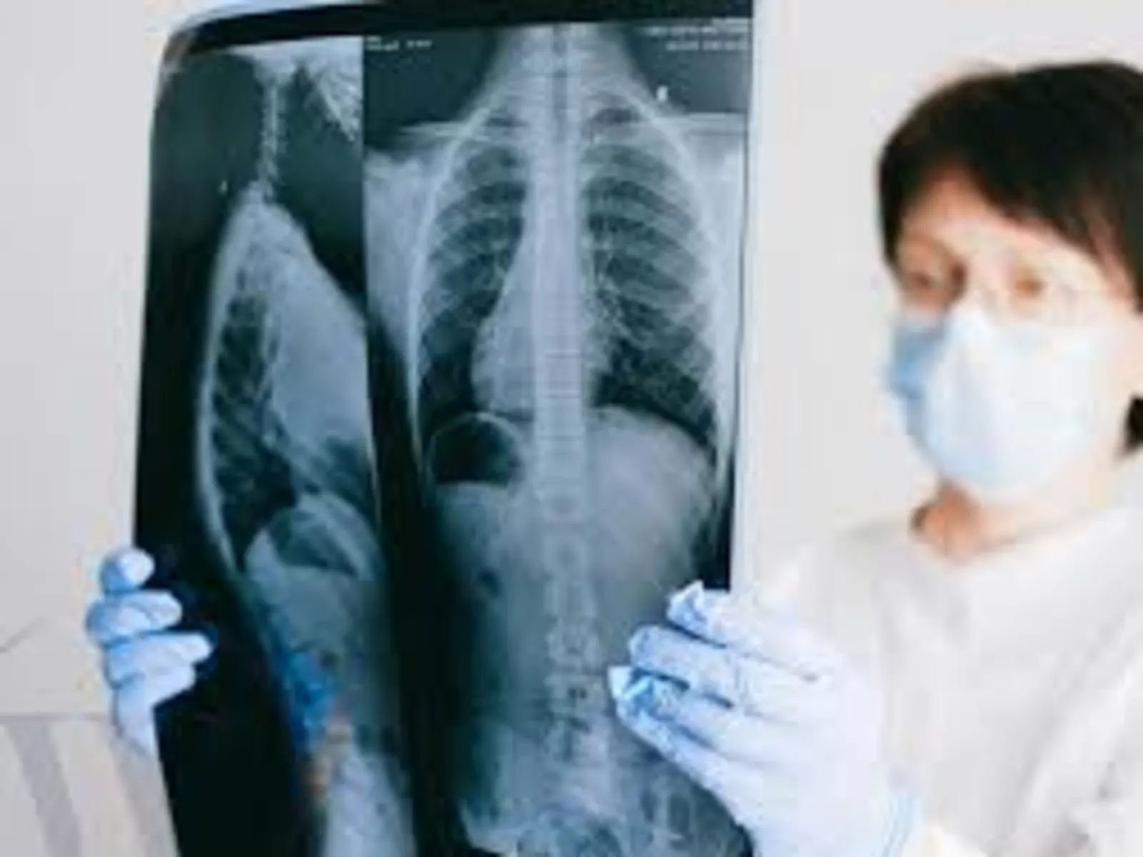 COPD and Cough: What You Need to Know
