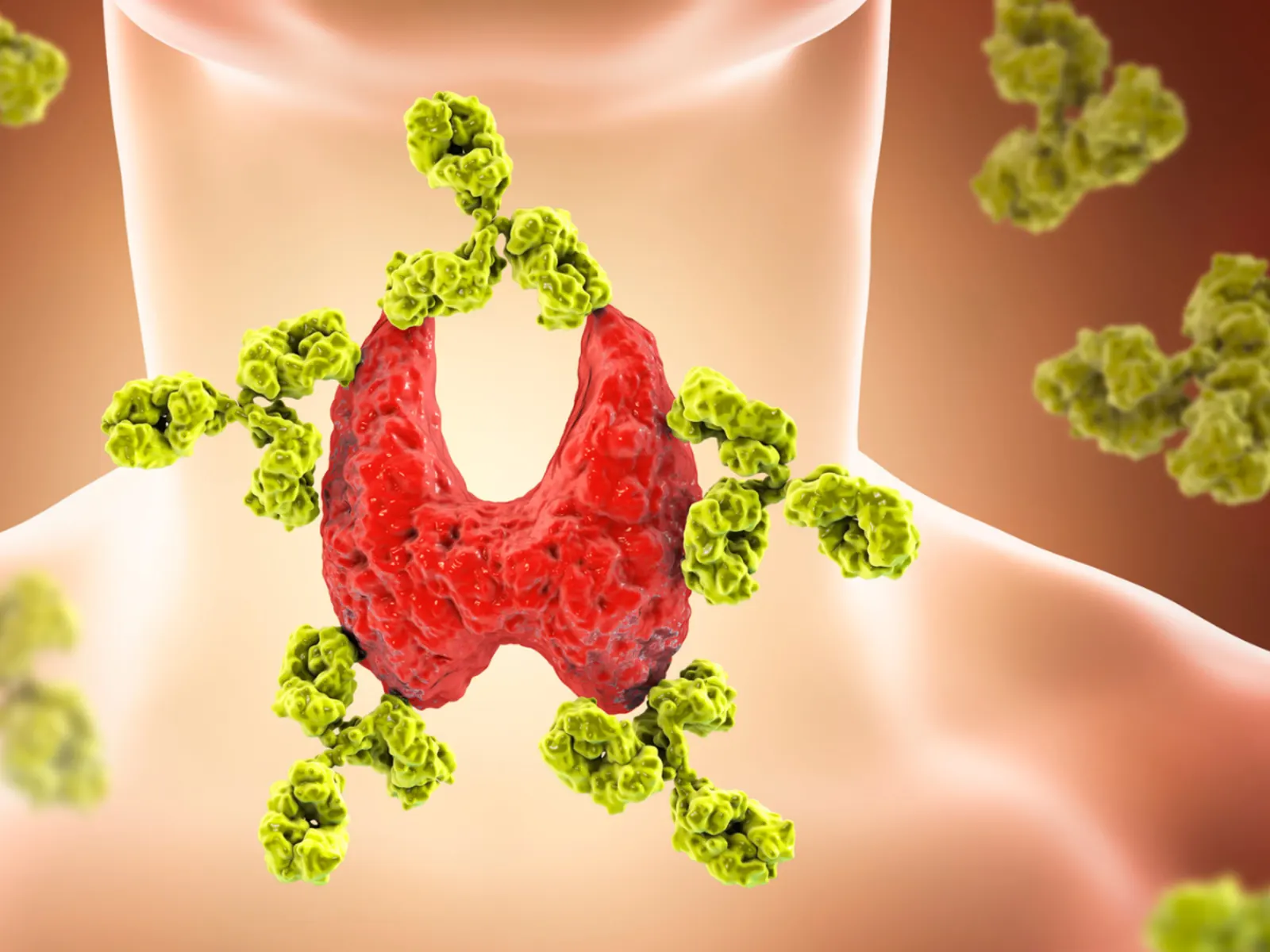 Types Of Thyroid Disorders: What Are The Main Conditions And What Causes Them