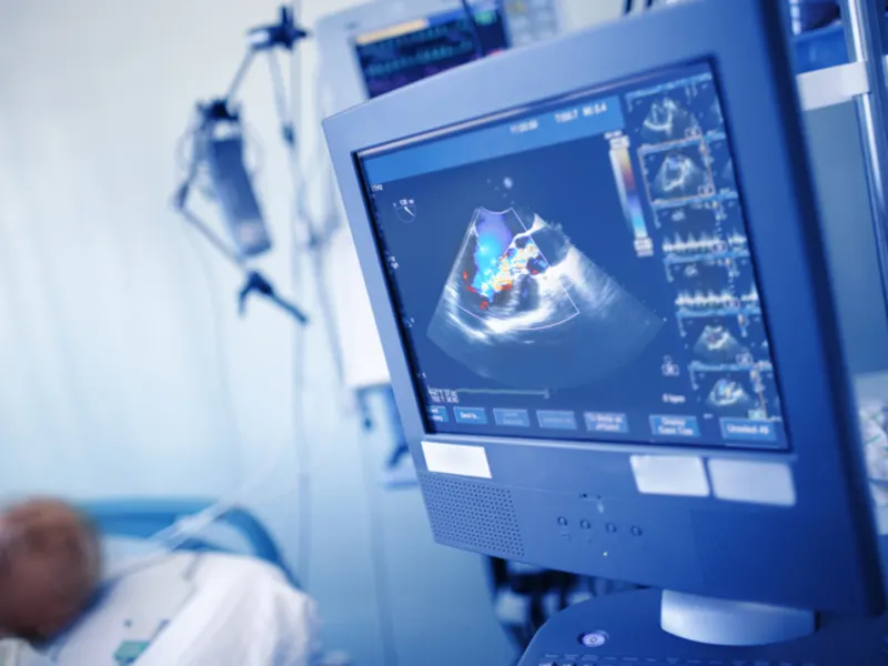 Heart Ultrasound Scans – What to Expect