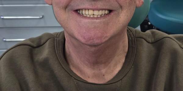 OESOPHAGEAL CANCER IN THE FAMILY  
        
          
          
        
