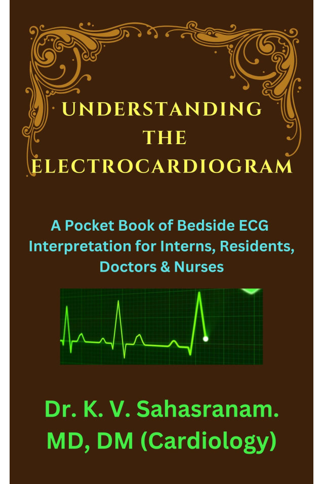 UNDERSTANDING THE ELECTROCARDIOGRAM: A Pocket Book of Bedside ECG interpretation for Interns, Residents, Doctors & Nurses