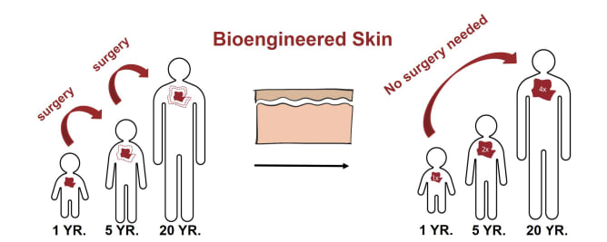 Vorteil von bioengineerter Haut