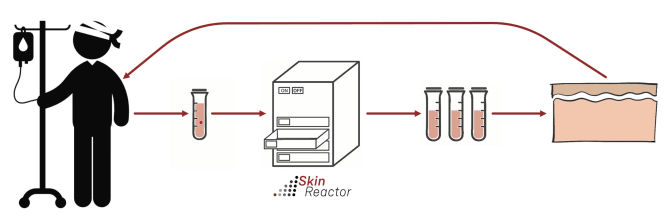 How to get bioengineered skin