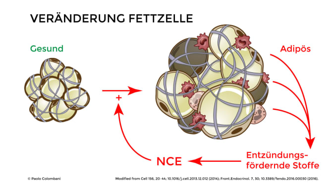 Zusammenhang NCE und Übergewicht