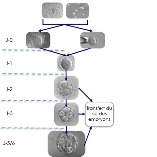 Culture de l’embryon 