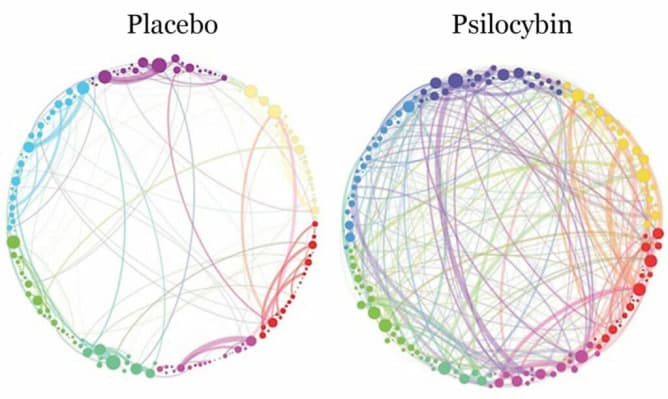 Vergleich zwischen Gehirnkonnektivität, Placebo und Psilocybin (G.Petri - 2014) 