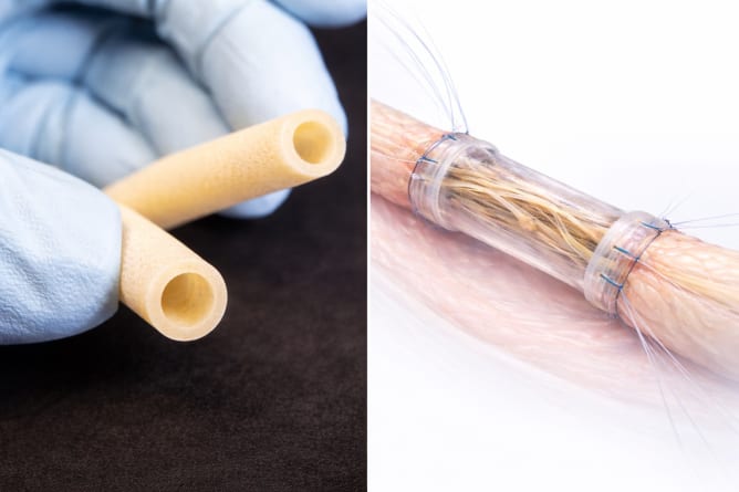 Spider silk based nerve conduits sample