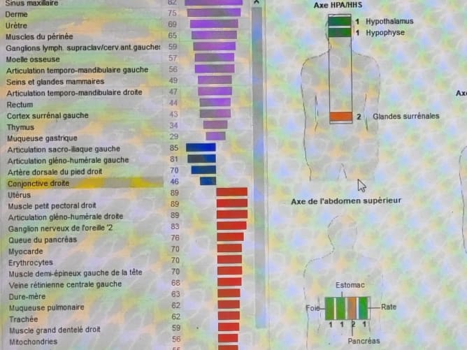 Exemple de graphique d'analyse Global Diagnostics