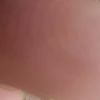 Story 1