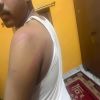 Story 1